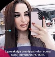 Bir ildə iki ölüm: Təsadüf, həkim səhlənkarlığı, yoxsa NAŞILIQ?