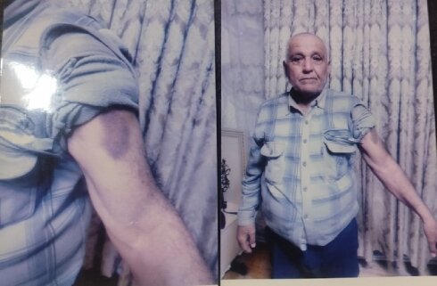 Mingəçevirdə 74 yaşlı taksi sürücüsünü döyən sahibkar niyə məsuliyyət cəlb olunmur ?-FOTOLAR
